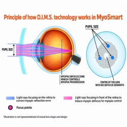 digital-bifocal